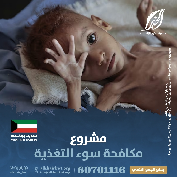 صورة مكافحة سوء التغذية